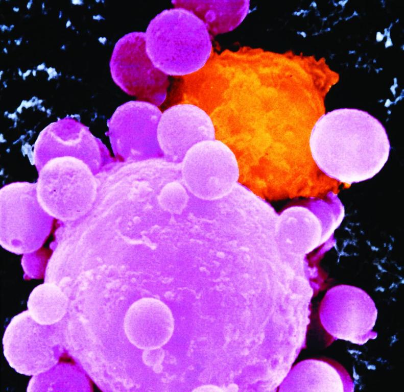 img-Cancer-cell1.jpg