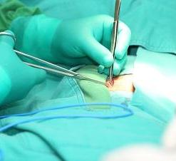 img-surgery1.jpg